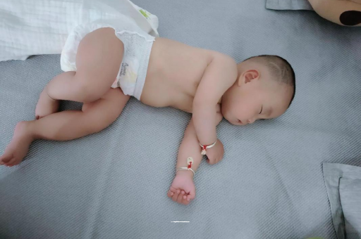 克孜勒苏柯尔克孜六个月宝宝眼睛散光